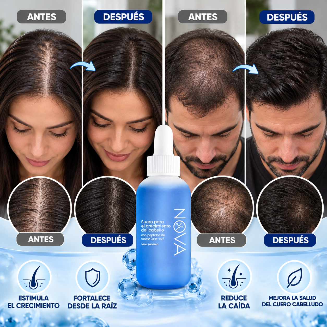 Nova- Suero Crecimiento Cabello